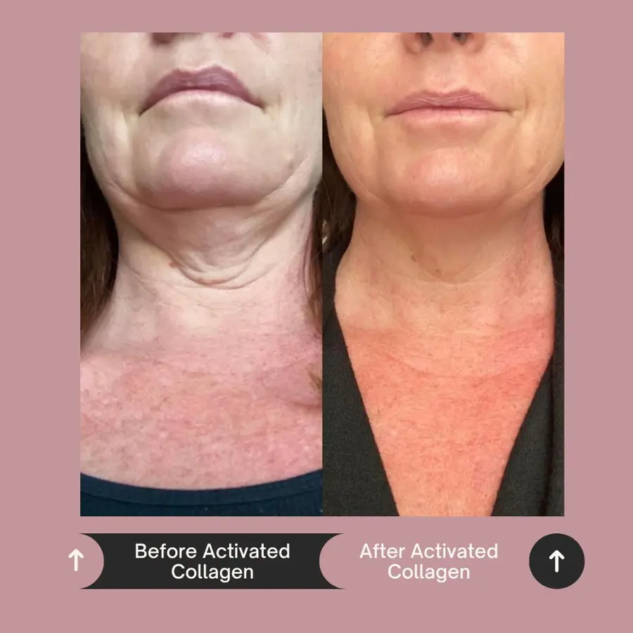Customer before and after photo