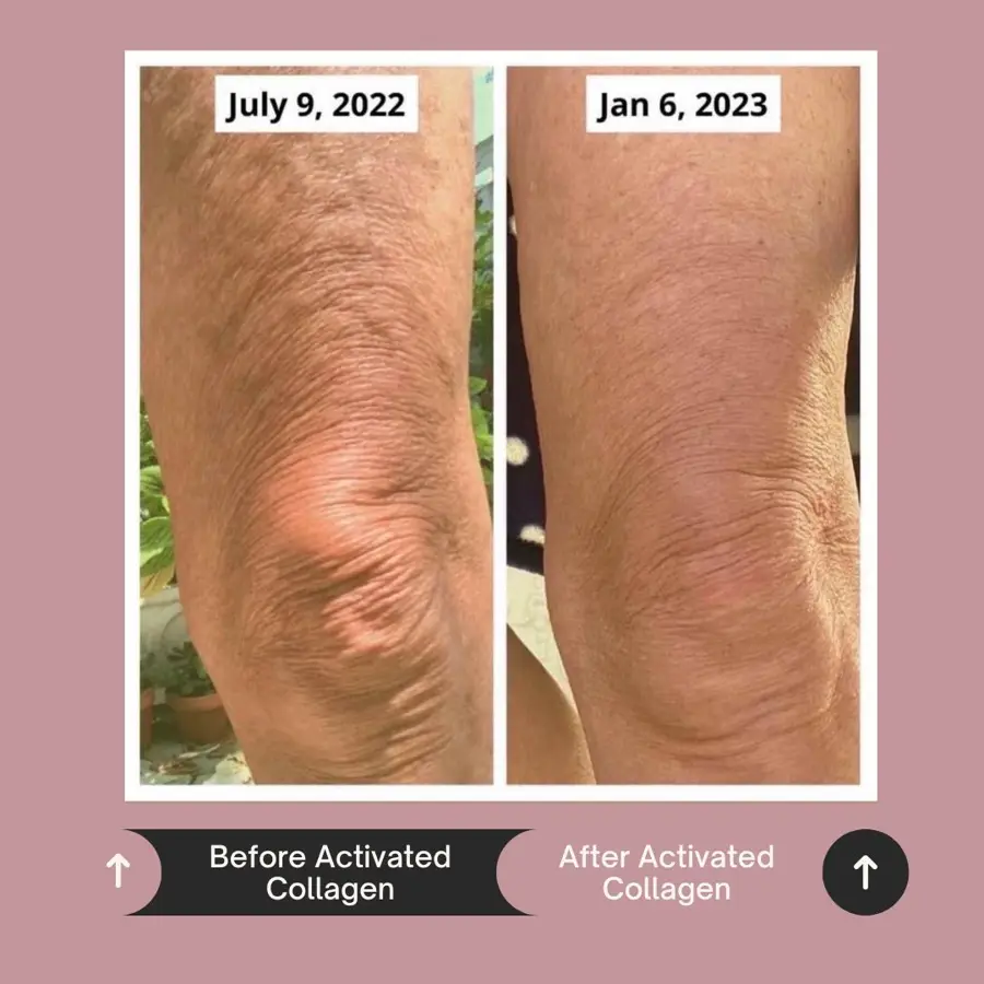 Customer before and after photo