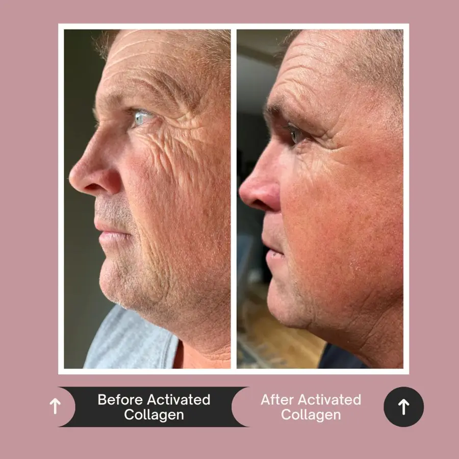 Customer before and after photo
