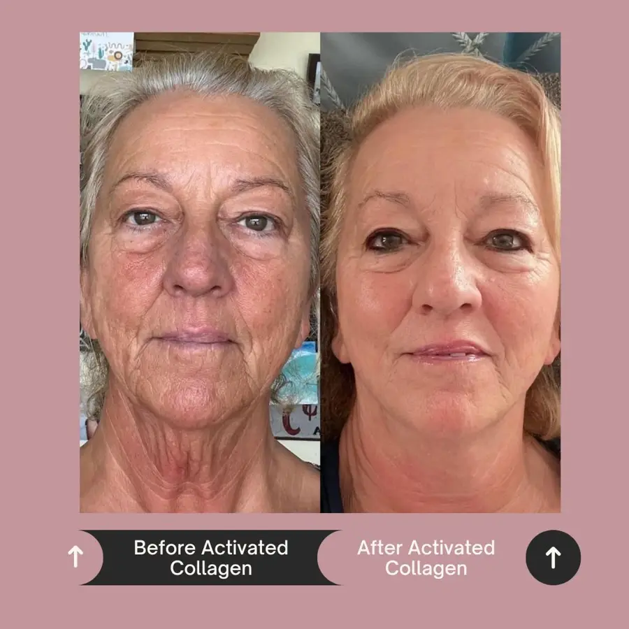 Customer before and after photo