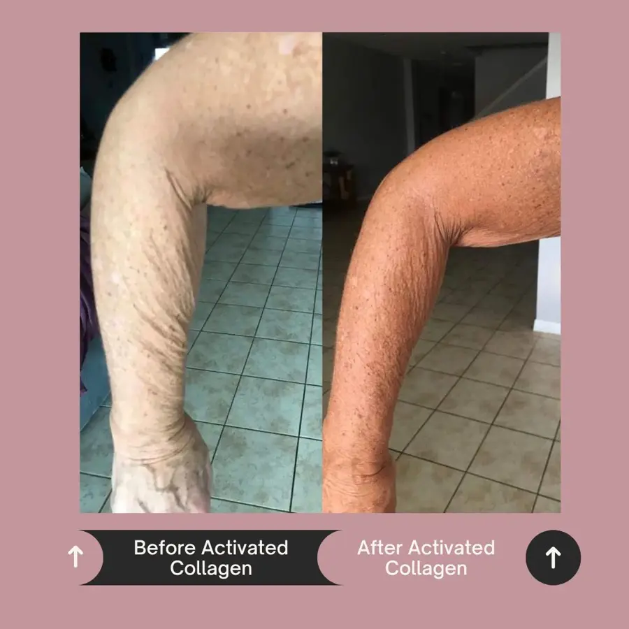 Customer before and after photo
