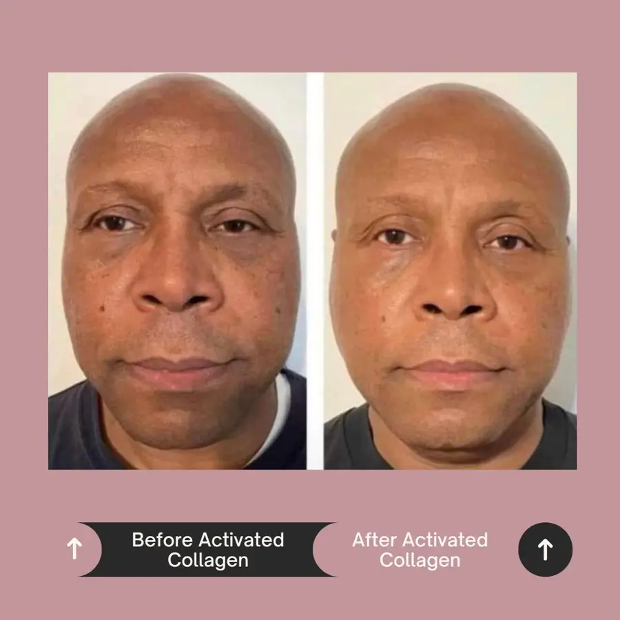 Customer before and after photo