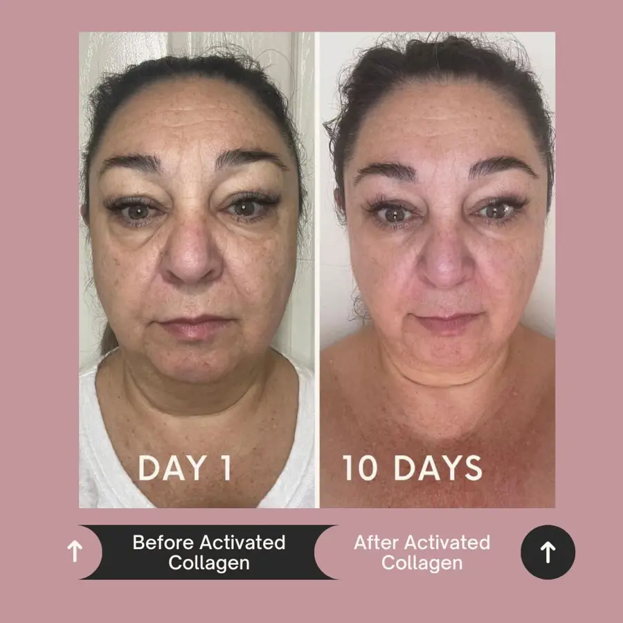 Customer before and after photo