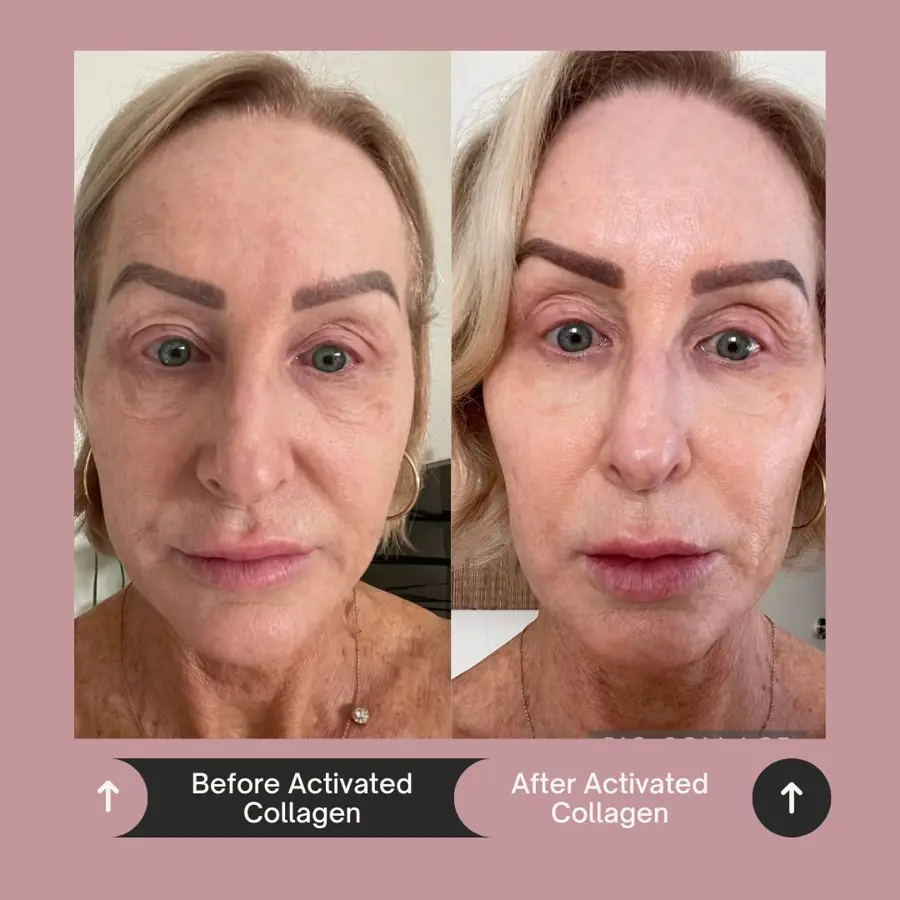 Customer before and after photo