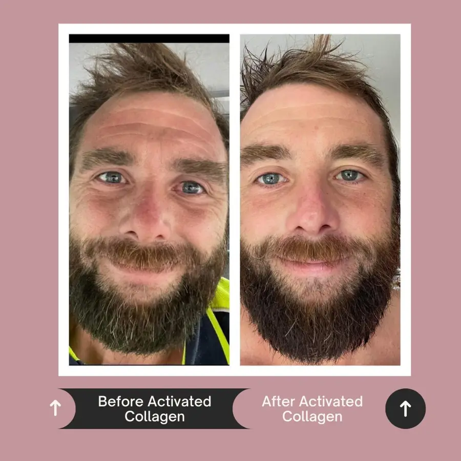 Customer before and after photo