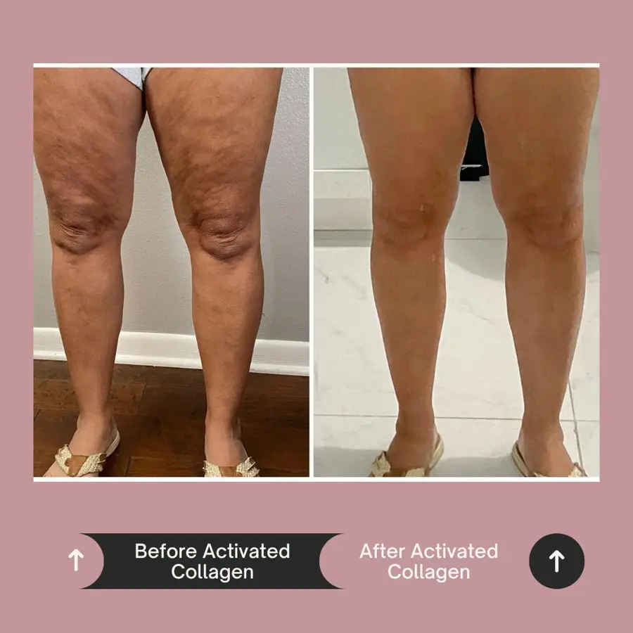 Customer before and after photo