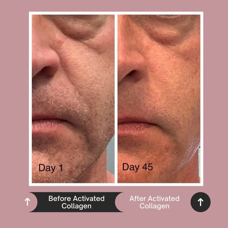Customer before and after photo